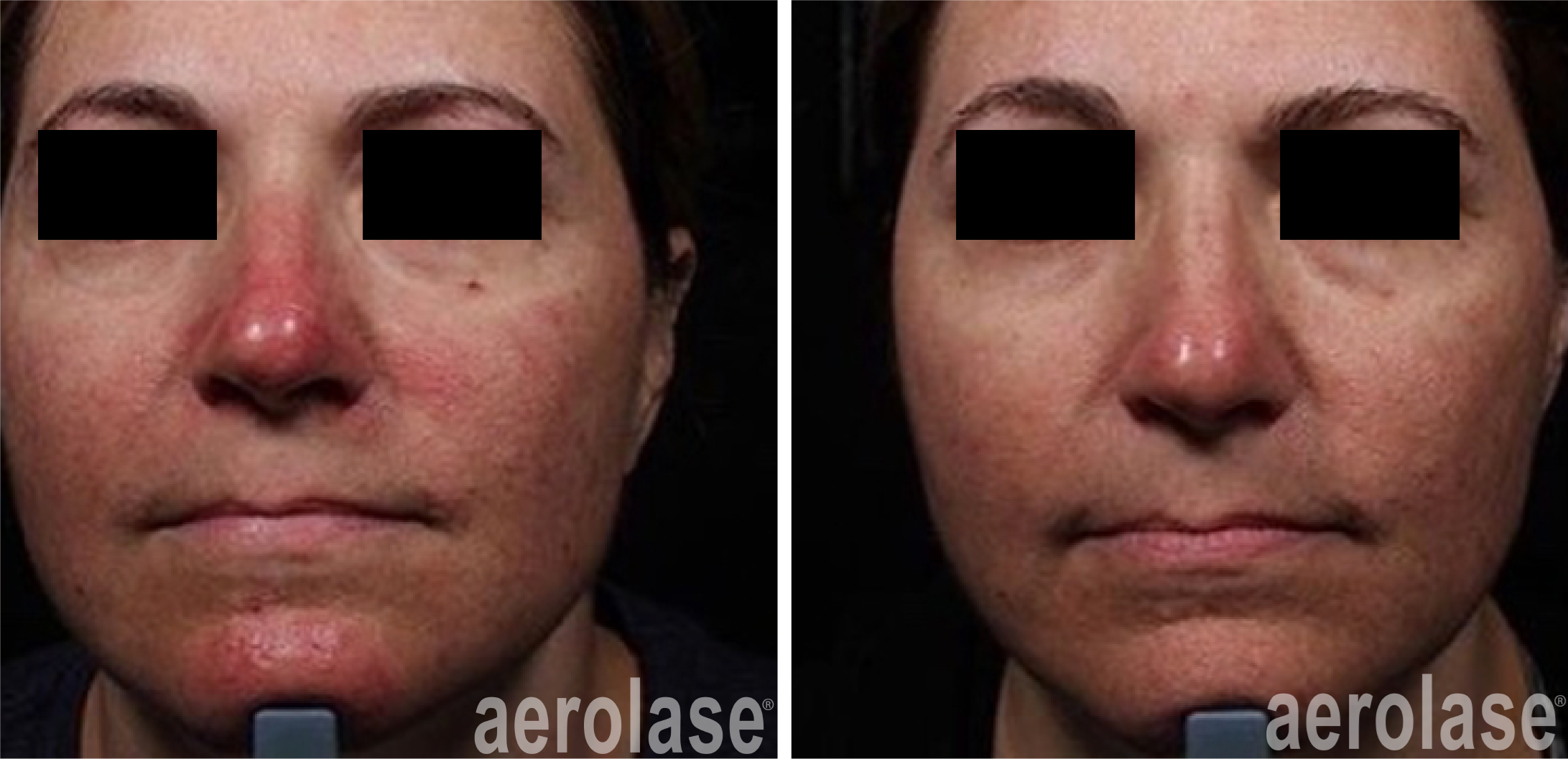 Before & After