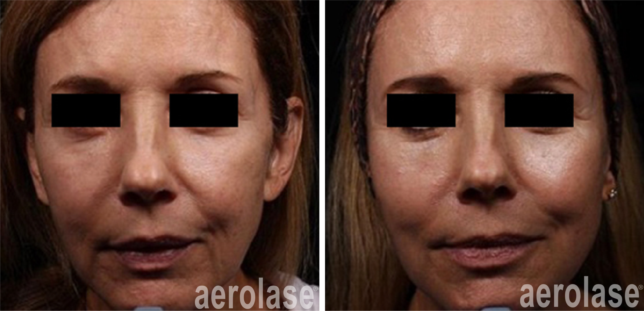 Before & After