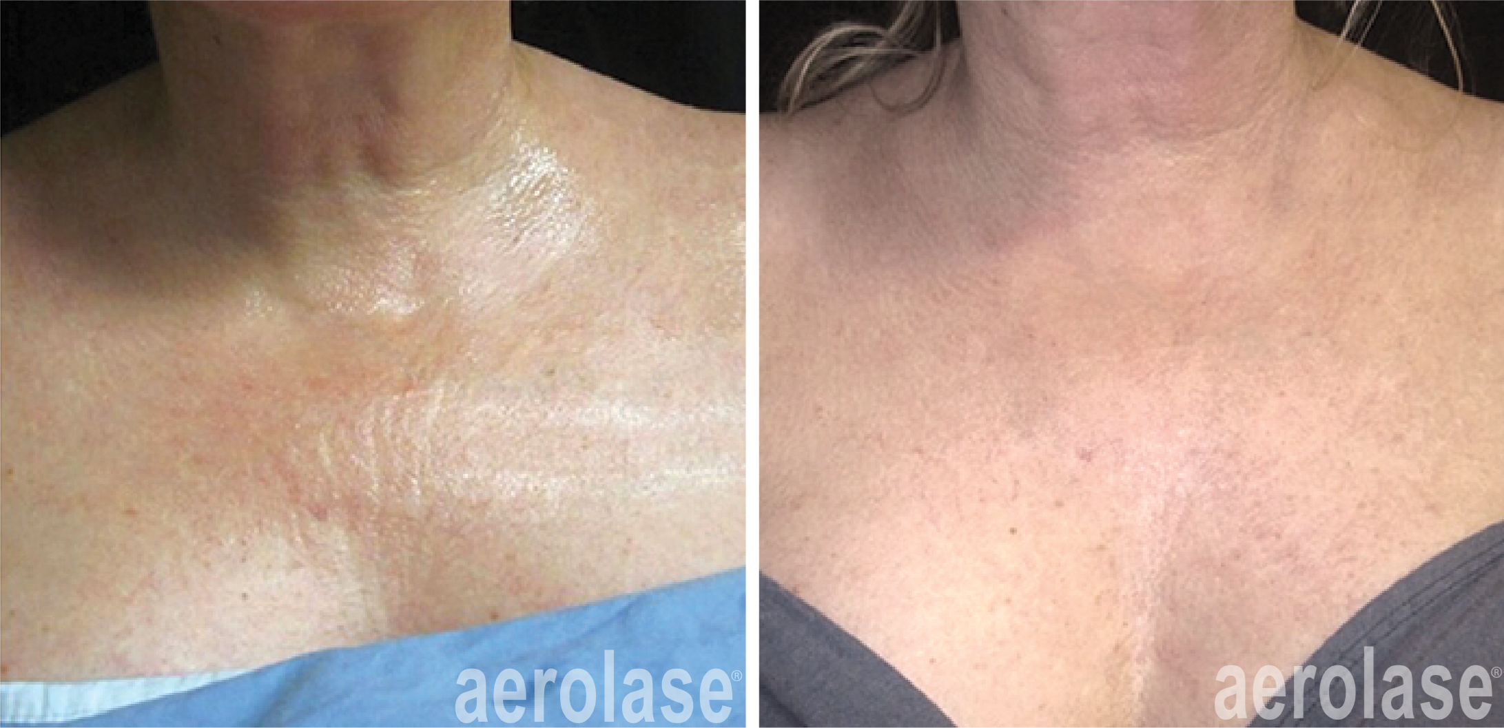 Before & After