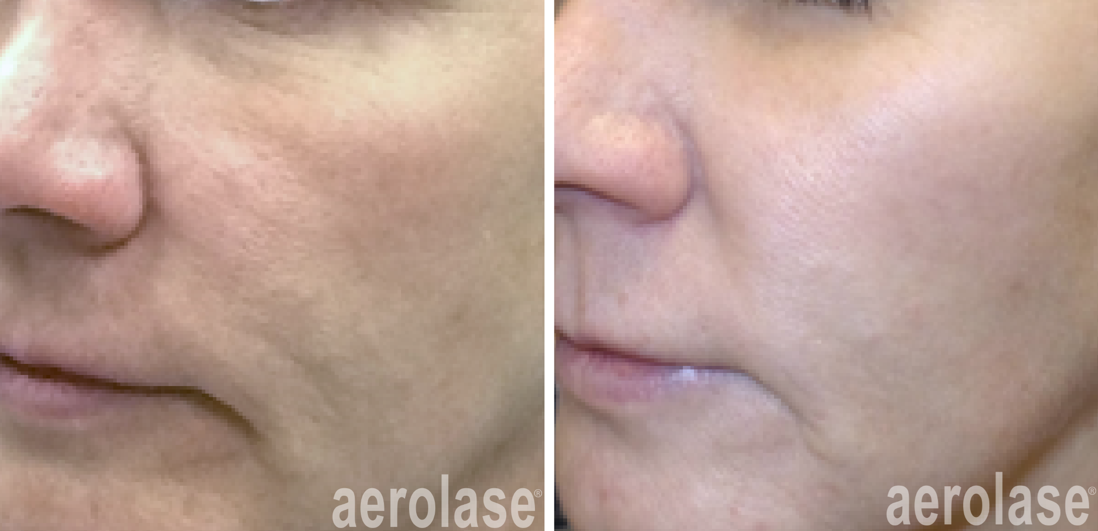 Before & After