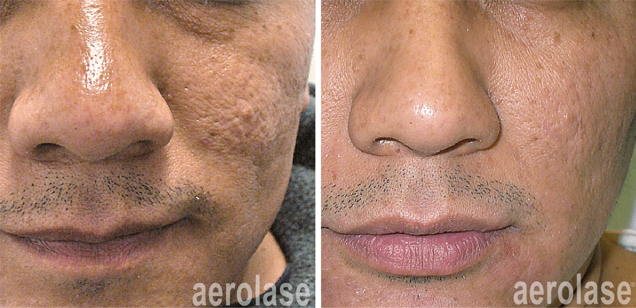 Before & After