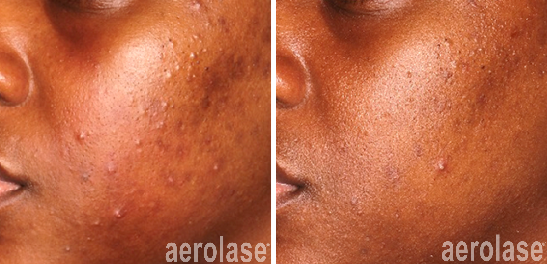 Before & After
