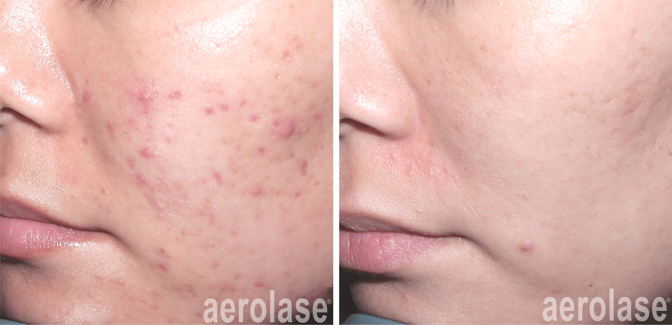 Before & After