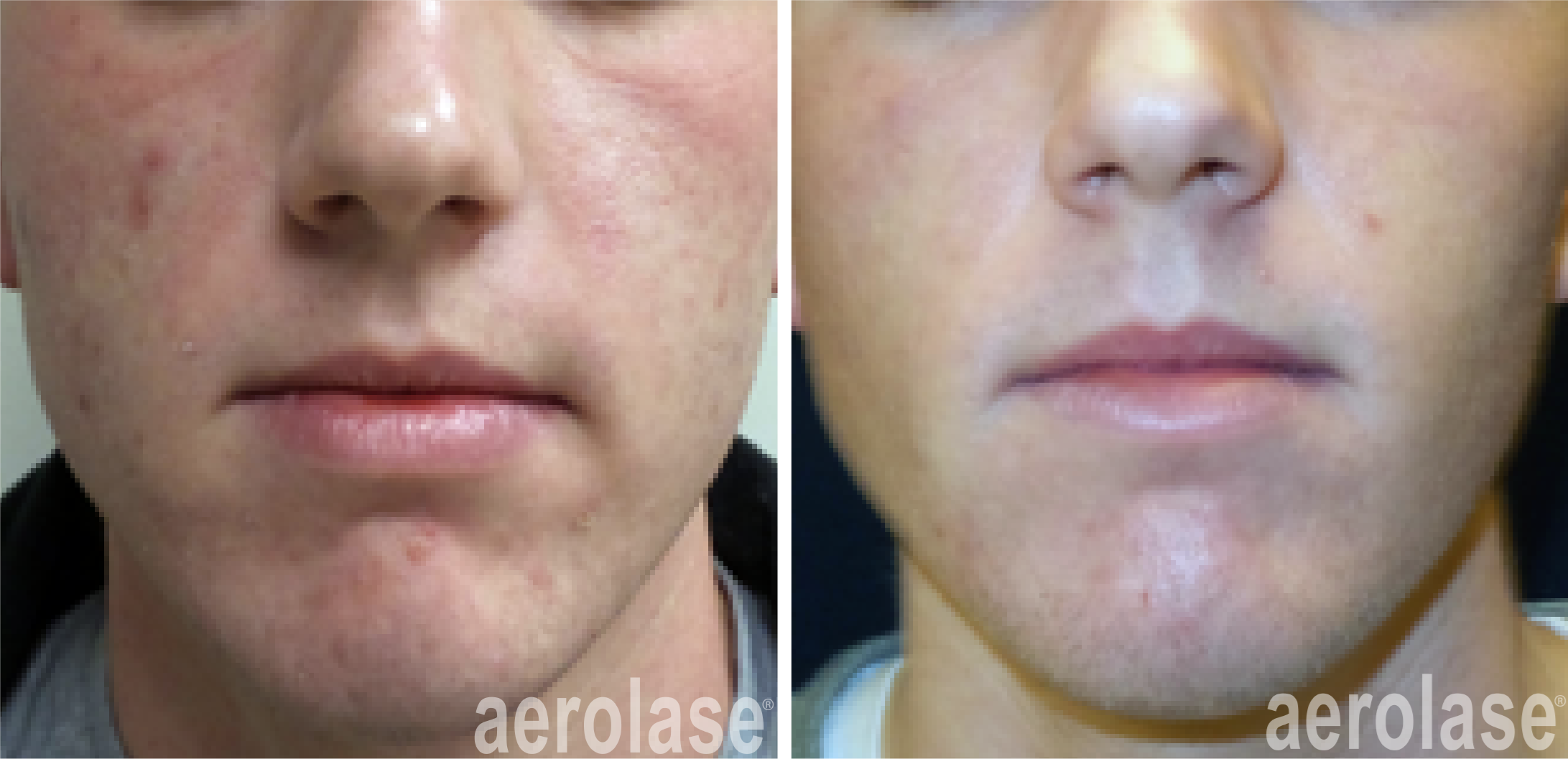 Before & After
