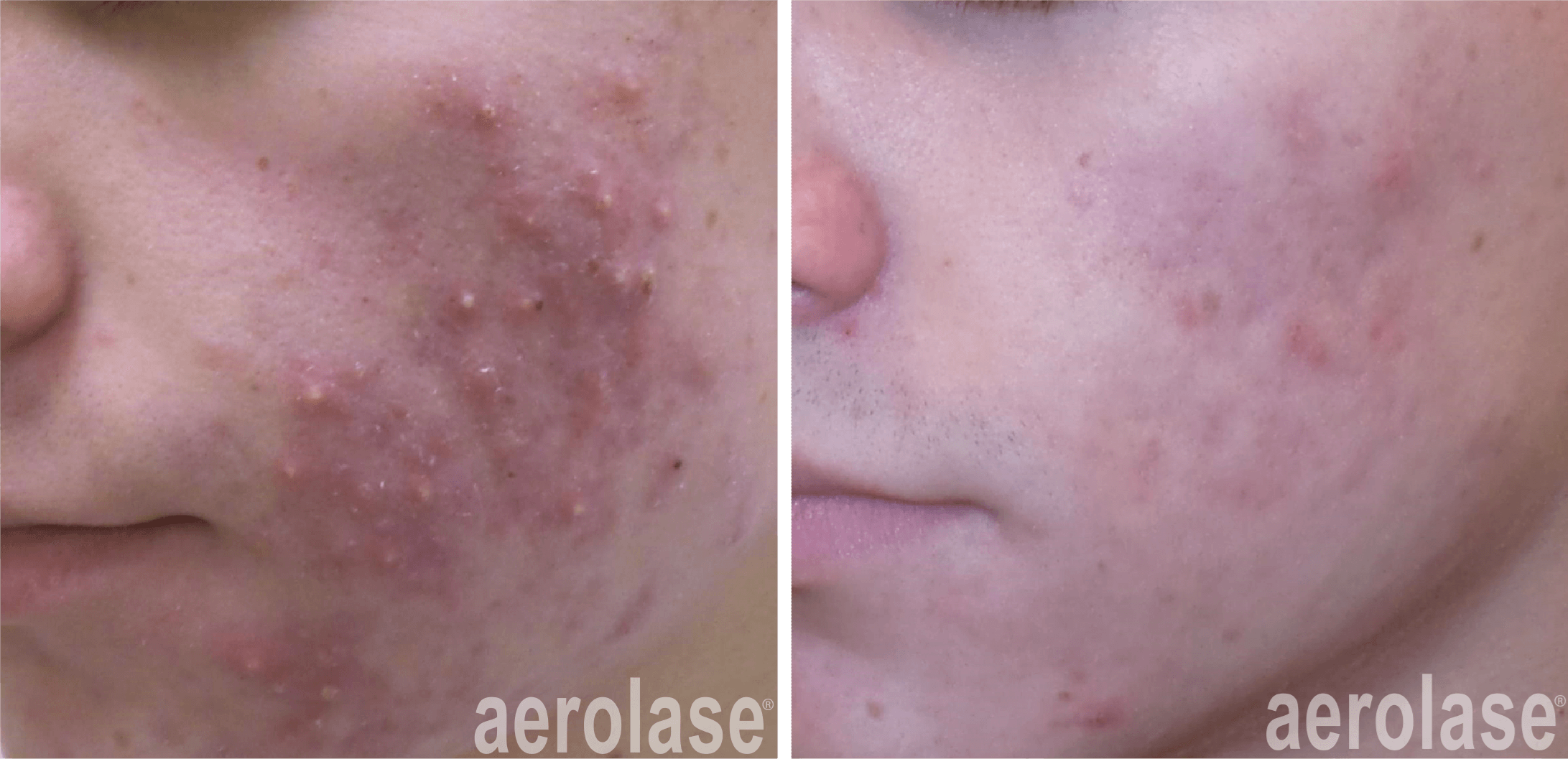 Before & After