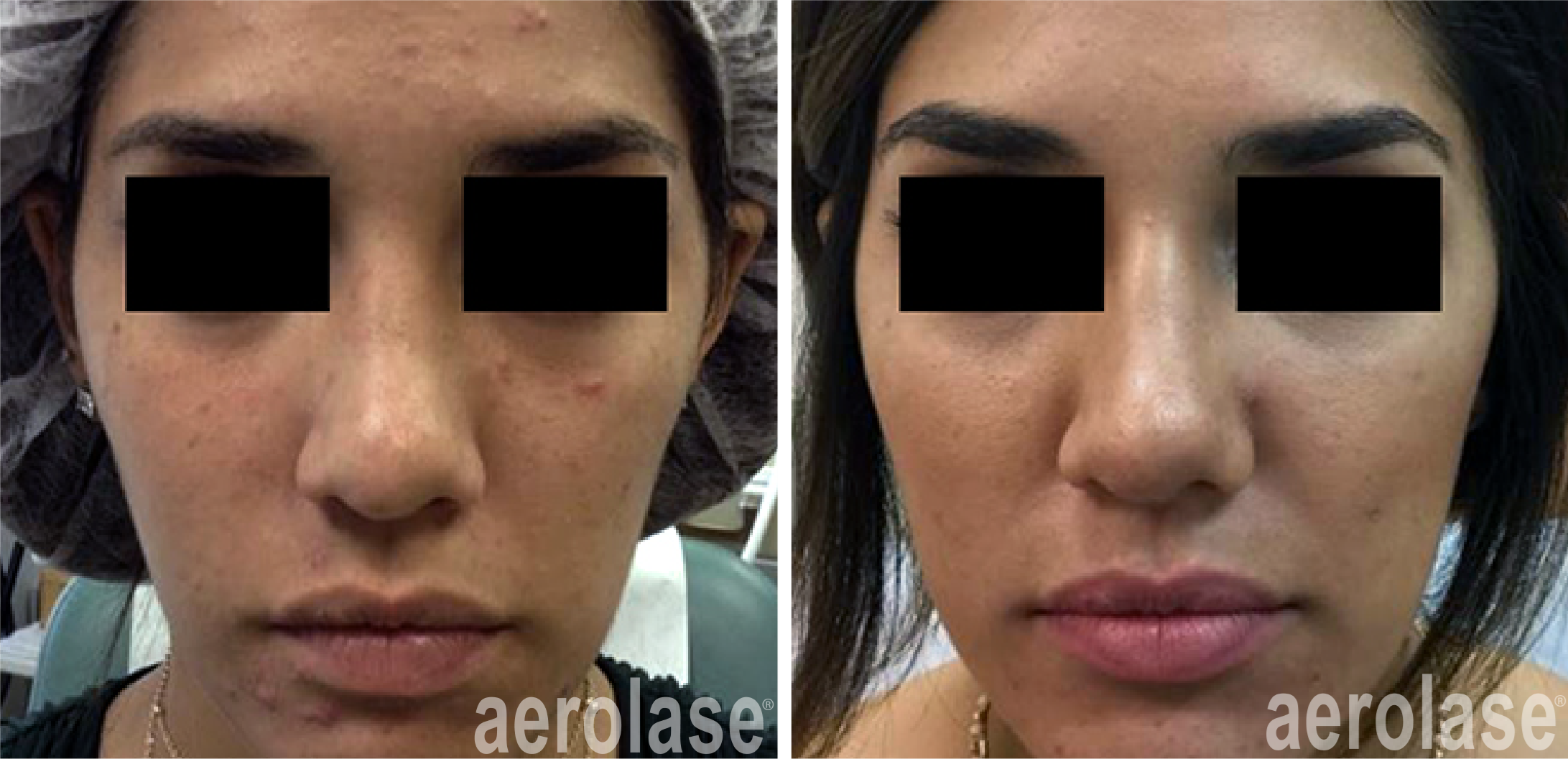 Before & After