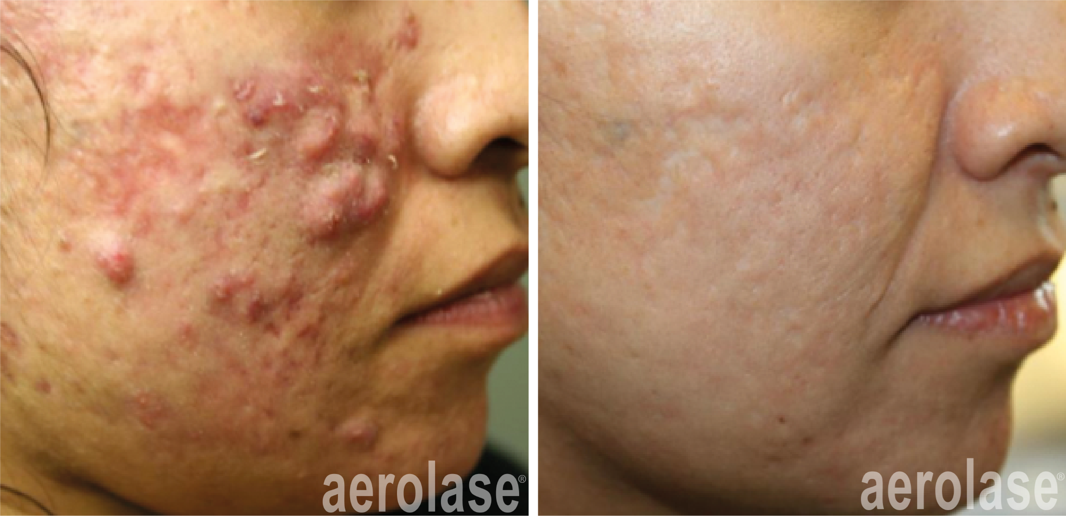 Before & After