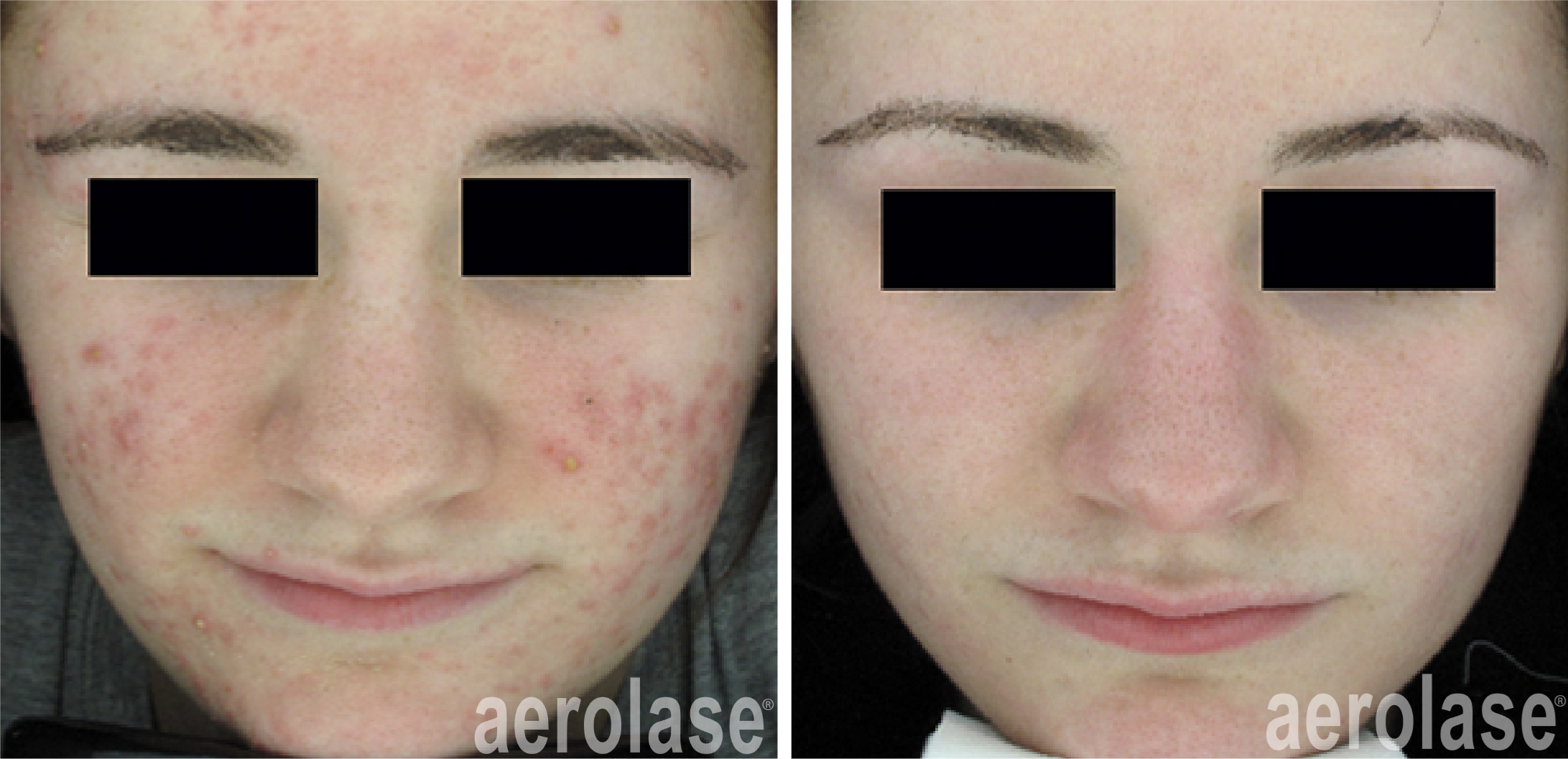 Before & After