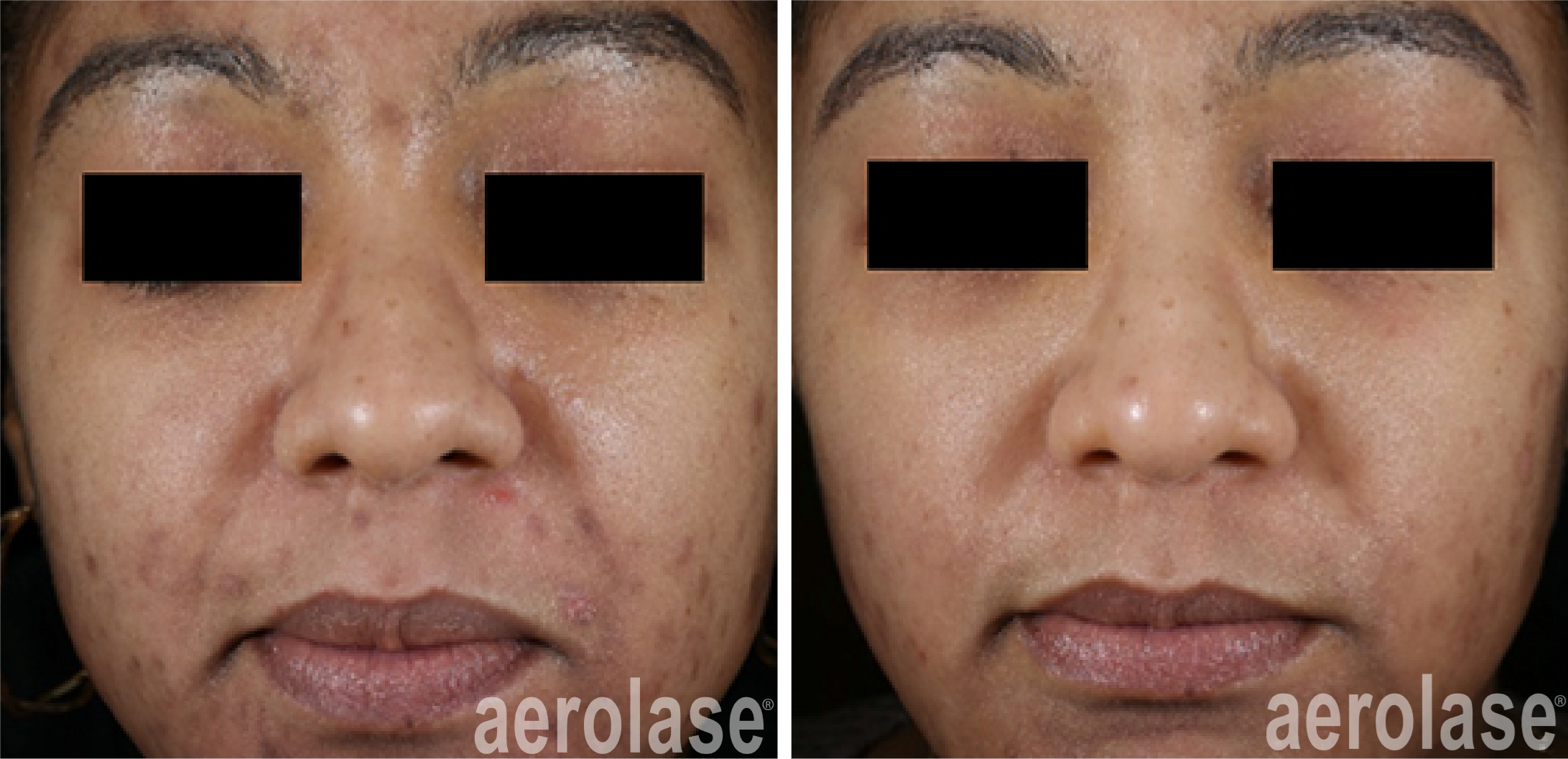 Before & After